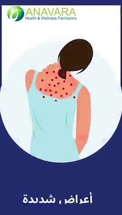 أعراض شديدة للحساسية اللاتكس _shorts(360P)