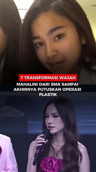 7 Transformasi wajah Mahalini dari SMA sampai akhirnya putuskan operasi plastik