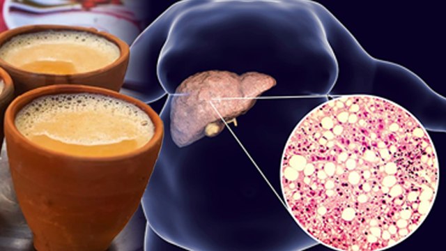 फैटी लिवर में चाय पीना चाहिए या नहीं | Fatty Liver Me Chai Pina Chahiye Ya Nahi | Boldsky