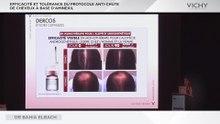 Efficacité et tolérance du protocole antichute de cheveux à base d'Aminexil par Dr B. ELBACH