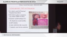 Alopécie frontale fibrosante en 2024 par Dr P. REYGAGNE 2