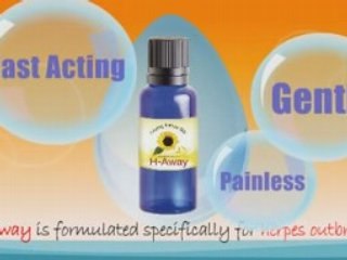 Treat Genital Herpes - Natural Way to Treat Herpes HSV@ and