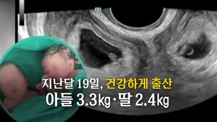 [지금e뉴스] 매크로 암표상 /  쌍자궁 / 81세 미스 유니버스 / YTN