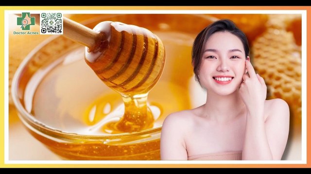 Cách trị mụn bằng mật ong hiệu quả, an toàn, dễ thực hiện