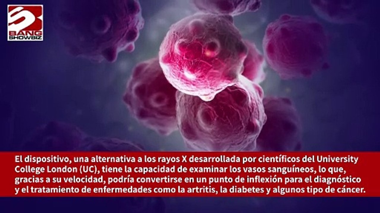 Un escáner innovador y una alternativa a los rayos X podrían revolucionar el tratamiento de enfermedades como el cáncer