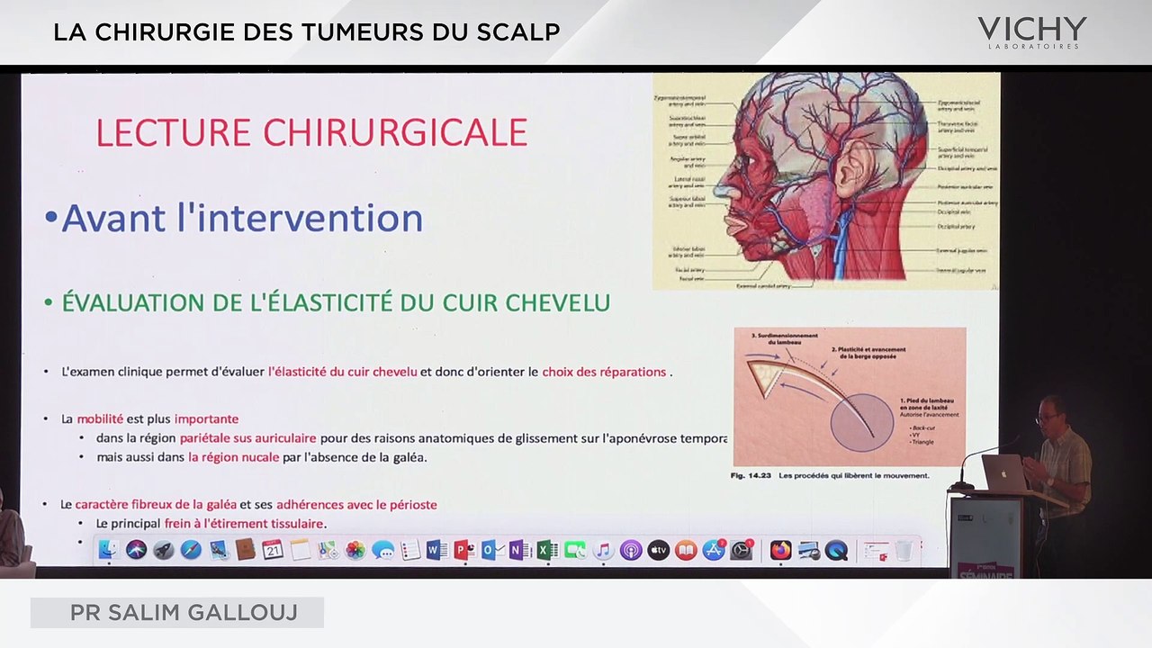 La chirurgie des tumeurs du SCALP par Pr S. GALLOUJ