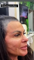 Gretchen choca ao aparecer sem prótese capilar: 'Perdi todo o cabelo'