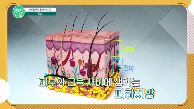 중년의 복부비만♨ 나이가 들수록 찌는 뱃살! 이렇게 치료하세요 #뱃살치료