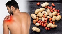 High Uric Acid Me Moongfali Kha Sakte Hai | Benefits Of Eating Peanuts