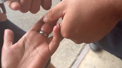 Firefighters remove ring that got stuck on girl's finger during night out