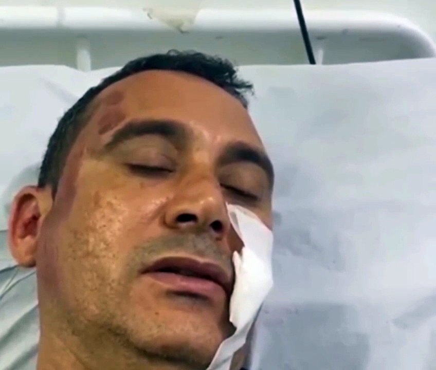 Candidato a vereador de cidade baiana é agredido com socos e pontapés