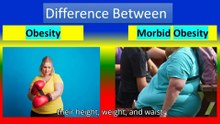 "BRI vs BMI: Why Doctors Prefer This New Health Metric to Measure Your Body Shape"