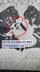 Doctor describes his most extrordinary case