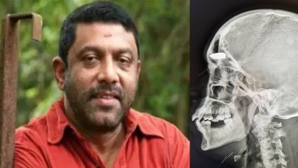 Mohan Raj 70 Age Demise Reason, Parkinson Causes, Symptoms, Treatment...