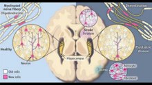 "5X Your BRAIN CELLS: Unlocking Brain Rejuvenation with Glucose Reduction"