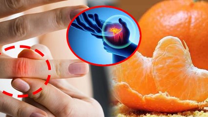 Download Video: Orange For High Uric Acid: Uric Acid Me Santra Khana Chahiye, Orange Benefits In Hindi...