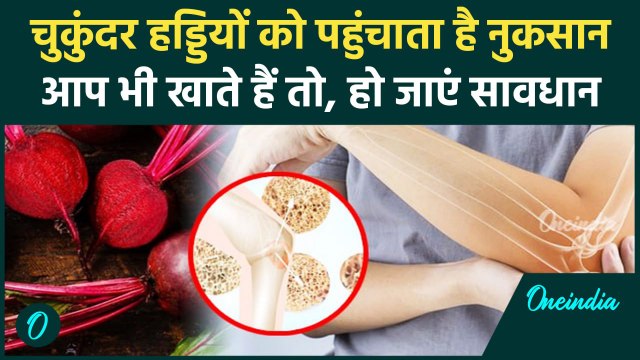 Beetroot Side Effects : चुकंदर खाने के खतरनाक परिणाम! Calcium की कमी से हड्डियों को नुकसान |वनइंडिया