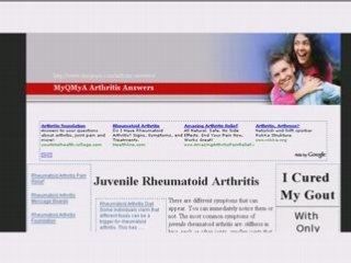 Arthritis Experts Write Arthritis Answers