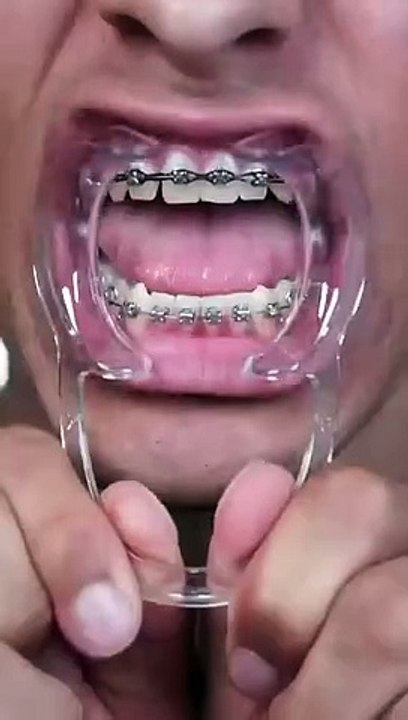 FEAST | FEASTABEL | TRENDING | MR BEAST | MR FEAST | BEST | TREND  | VIRAL VIDEO