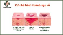 Sẹo rỗ là gì? Nguyên nhân và cơ chế hình thành sẹo rỗ