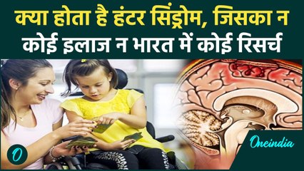क्या होता है Hunter Syndrome, जो बचपन में ही बना लेता है अपना शिकार | Causes & Cure | वनइंडिया हिंदी