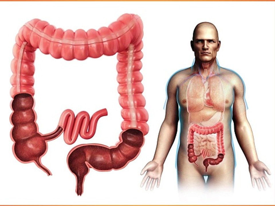 colitis symptoms causes and treatment in hindi || कोलाइटिस की पूरी जानकारी