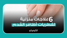6 علاجات منزلية لفطريات أظافر القدم