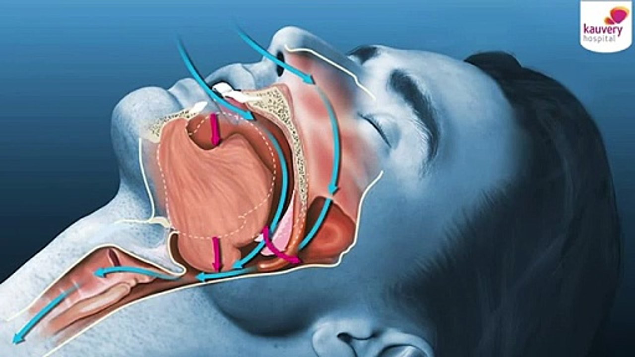Snoring: Disorder or Symptom?