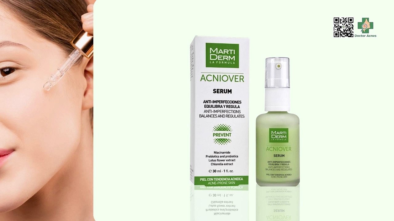 Top 5 serum trị mụn cho da dầu và cách sử dụng hiệu quả