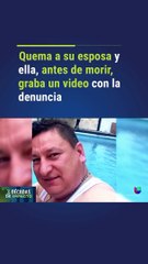 “¡Quería verme sufrir!” Un hombre le prendió fuego a su pareja y vio cómo sufría