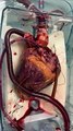 A human heart awaiting transplant. This is how it beats inside your body every single blessed day. The moment it ceases, you are dead