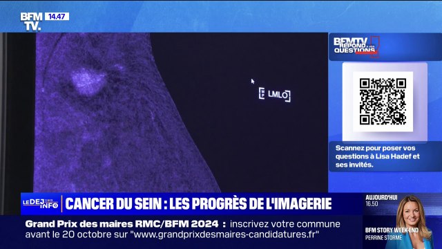 Cancer du sein: des progrès technologiques dans l'imagerie améliorent la prise en charge des patientes