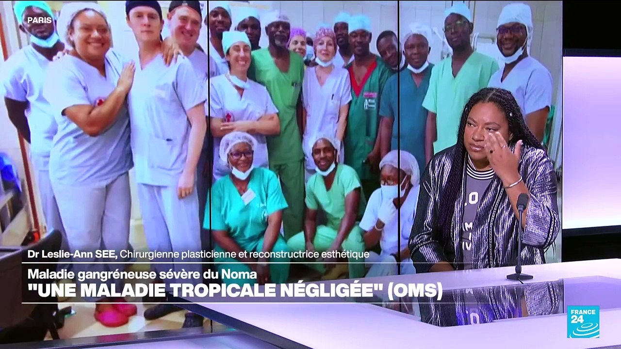 Le noma, une "maladie tropicale négligée" selon l'OMS