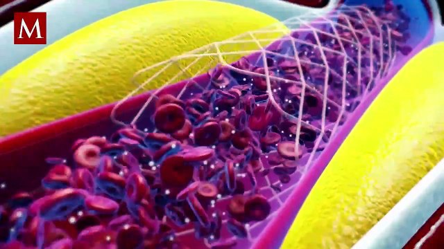 Esta es la fruta que ayuda a eliminar el colesterol malo de la sangre; evita problemas cardiacos así