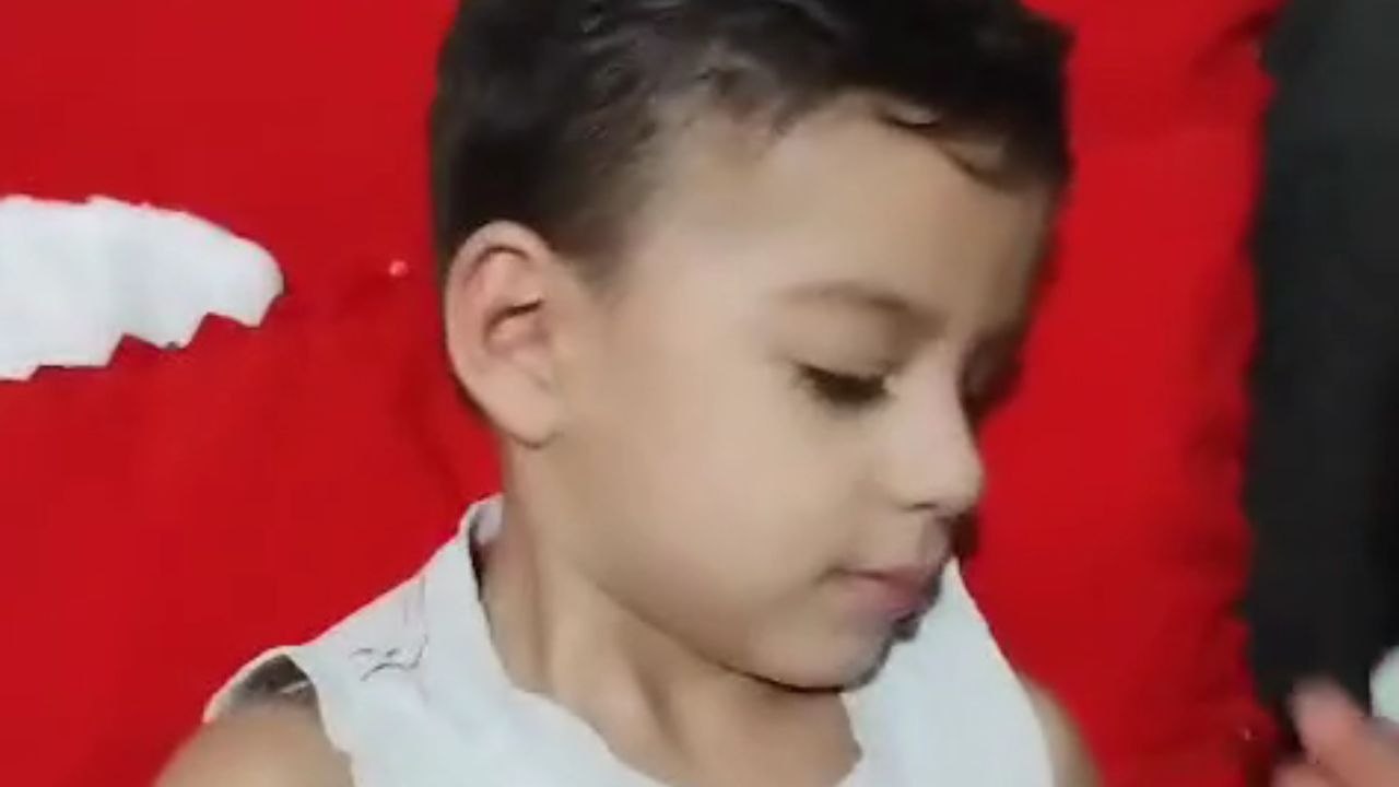 Mother puts the artificial eye in her son's eye socket *Unbelievable*