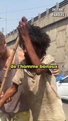 Cet homme aperçoit un homme boiteux puis lui offre une transformation unique