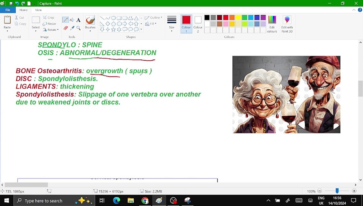 1. spinal cord compression