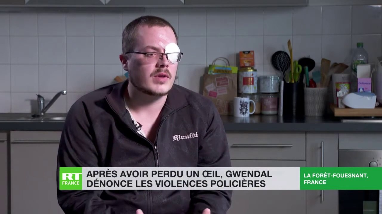 REPORT - PORTRAIT / REPORTAGE, PORTRAIT, GWENDAL MUTILÉ PAR LES FORCES DE L'ORDRE PENDANT UNE MANIF GJ