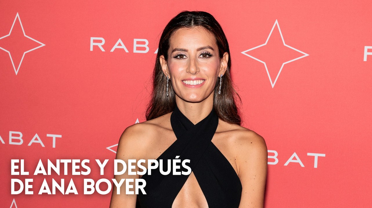 El antes y después de Ana Boyer