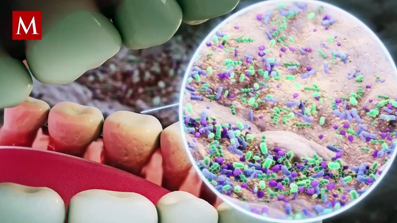 El mal aliento podría ser señal de un problema de salud más grave; te decimos de cuáles se trata