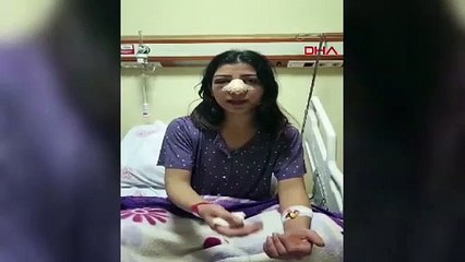 Genç kadının burnunu kıran AK Partili Başkan serbest