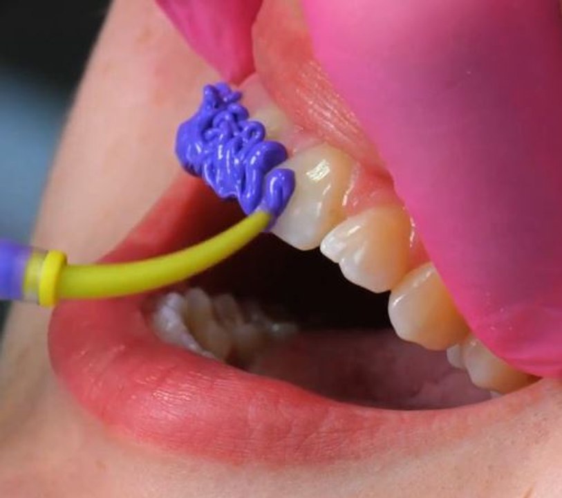 Rendez votre sourire inoubliable grâce à ces idées de griilz brillants !