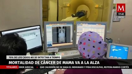 En México, el 70% de los casos de cáncer de mama no son detectados a tiempo