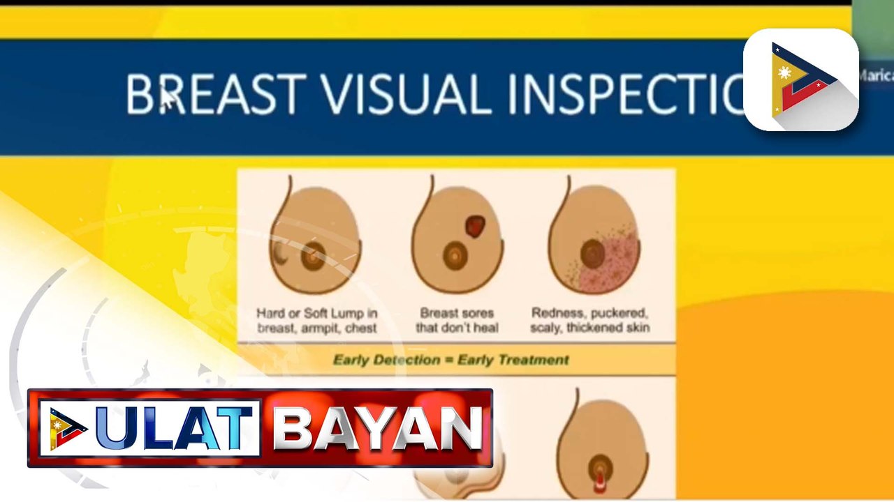 Kahalagahan ng pagkakaroon ng kaalaman tungkol sa sakit na breast cancer, binigyang-diin ng DOH