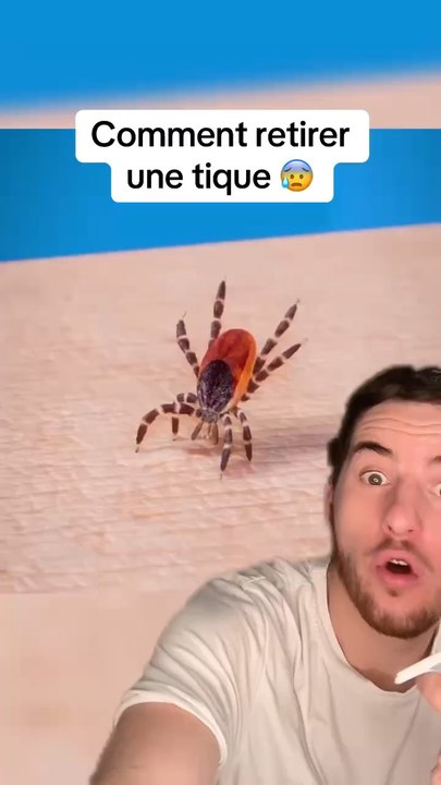 Retirer une tique