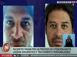 Aragua | Venezuela cuenta con especialistas y un protocolo efectivo para el tratamiento del vitiligo