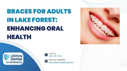 Braces for Adults in Lake Forest Enhancing Oral Health