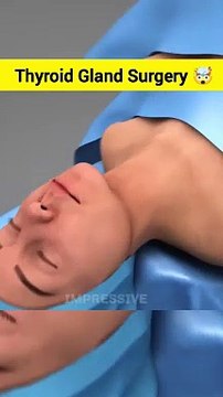 Thyroid Gland Surgery ASMR ANIMATION #shorts #asmr #animation