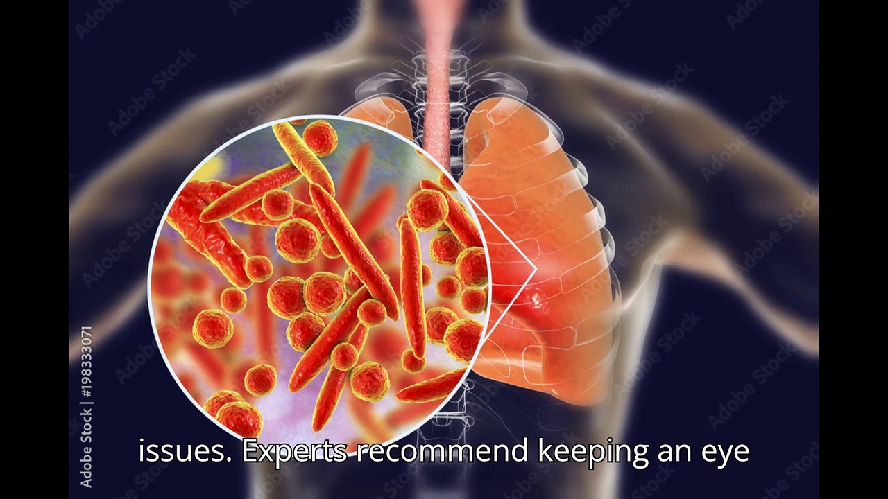 Walking Pneumonia Surge in Young Kids (2024)|Is Walking Pneumonia SURGING in Young Kids RIGHT NOW?
