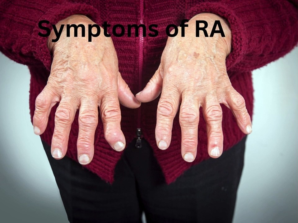 Rheumatoid arthritis information in hindi rheumatoid arthritis signs